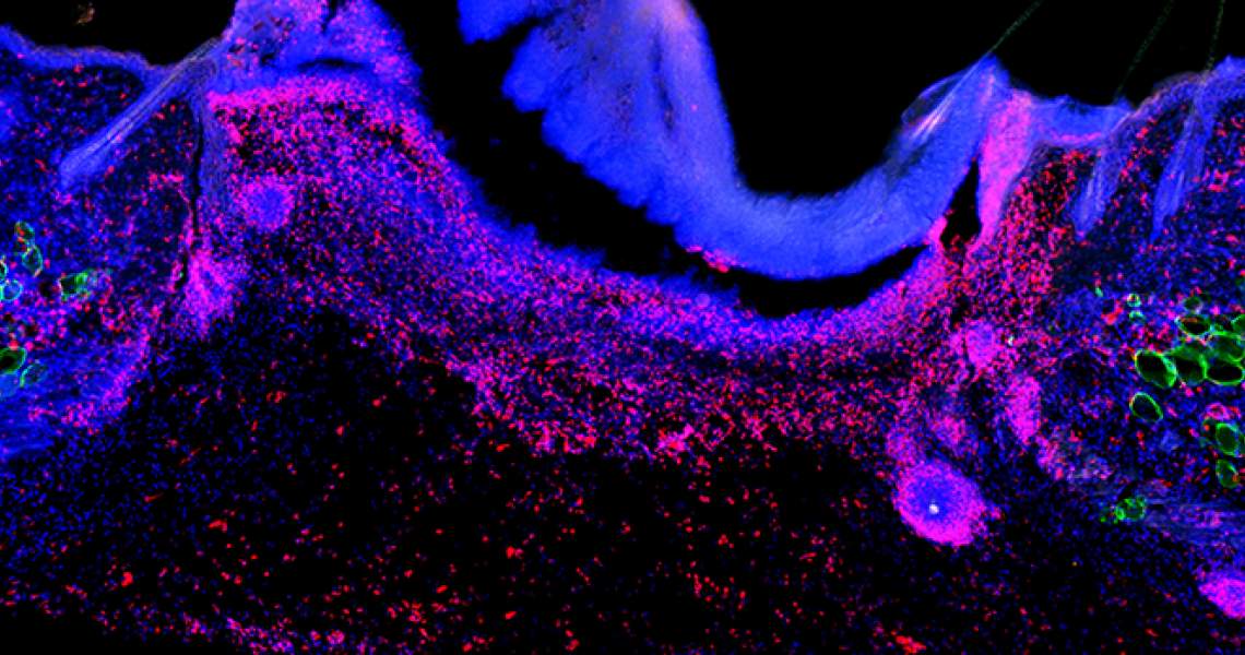 Immunostained tissue section