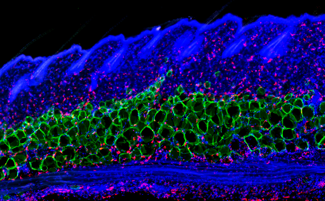 Immunostained tissue section